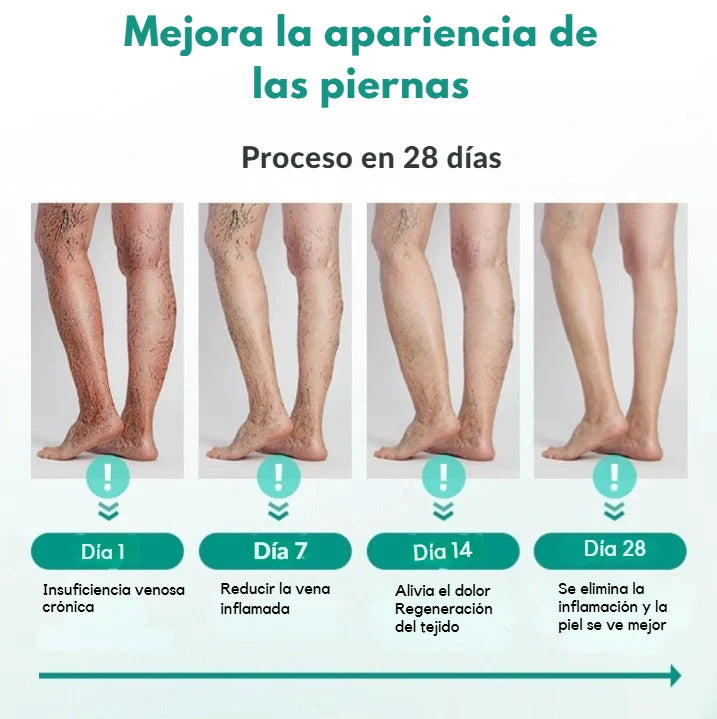 Parches Para Varices